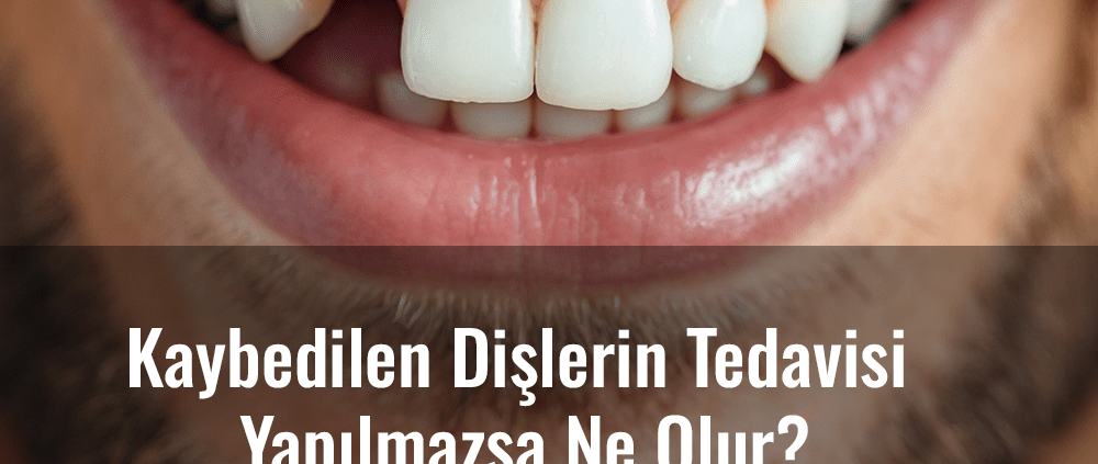 kaybedilen dişlerin tedavisi yapılmazsa ne olur, kayıp diş, eksik diş