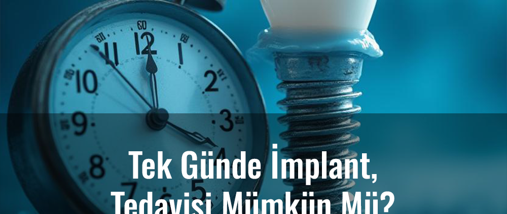 tek günde implant, ağrısız implant tedavisi, hızlı implant