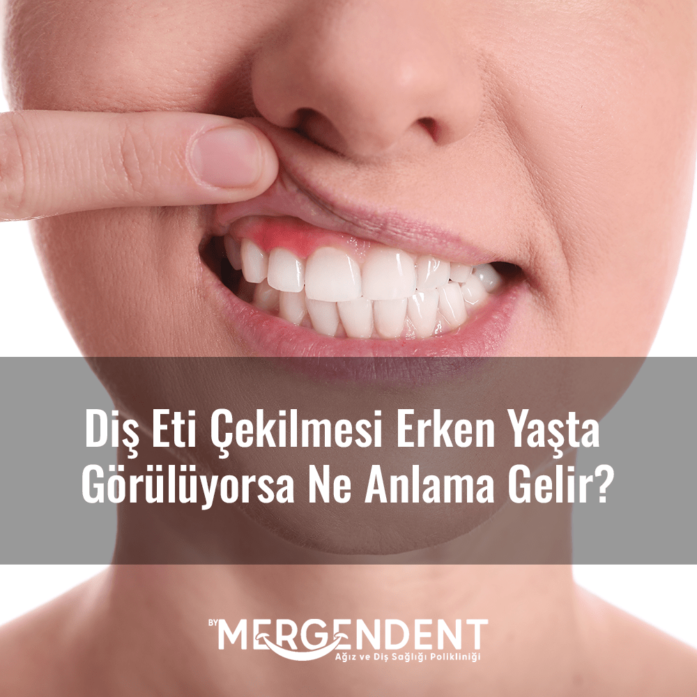 diş eti çekilmesi erken yaşta görülüyorsa ne anlama gelir? Erken yaşta diş eti çekilmesi