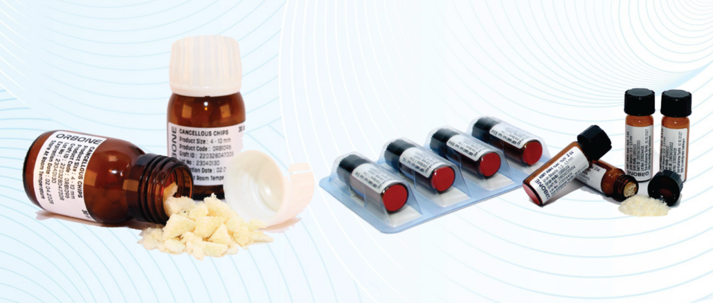 Kemik Grefti Nedir? İmplant Tedavisinde Neden Gerekli Olabilir? kemik grefti nedir