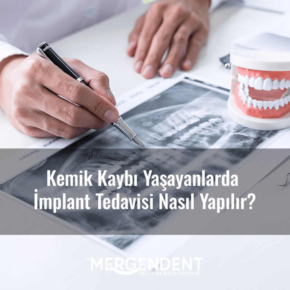 kemik kaybı ve implant