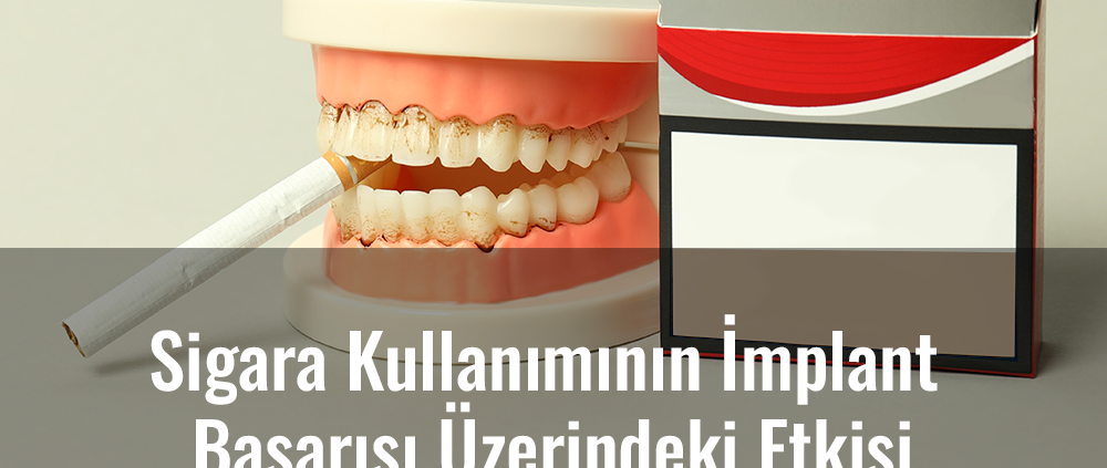 sigara kullanımının implant tedavisine etkisi, sigara ve implant tedavisi