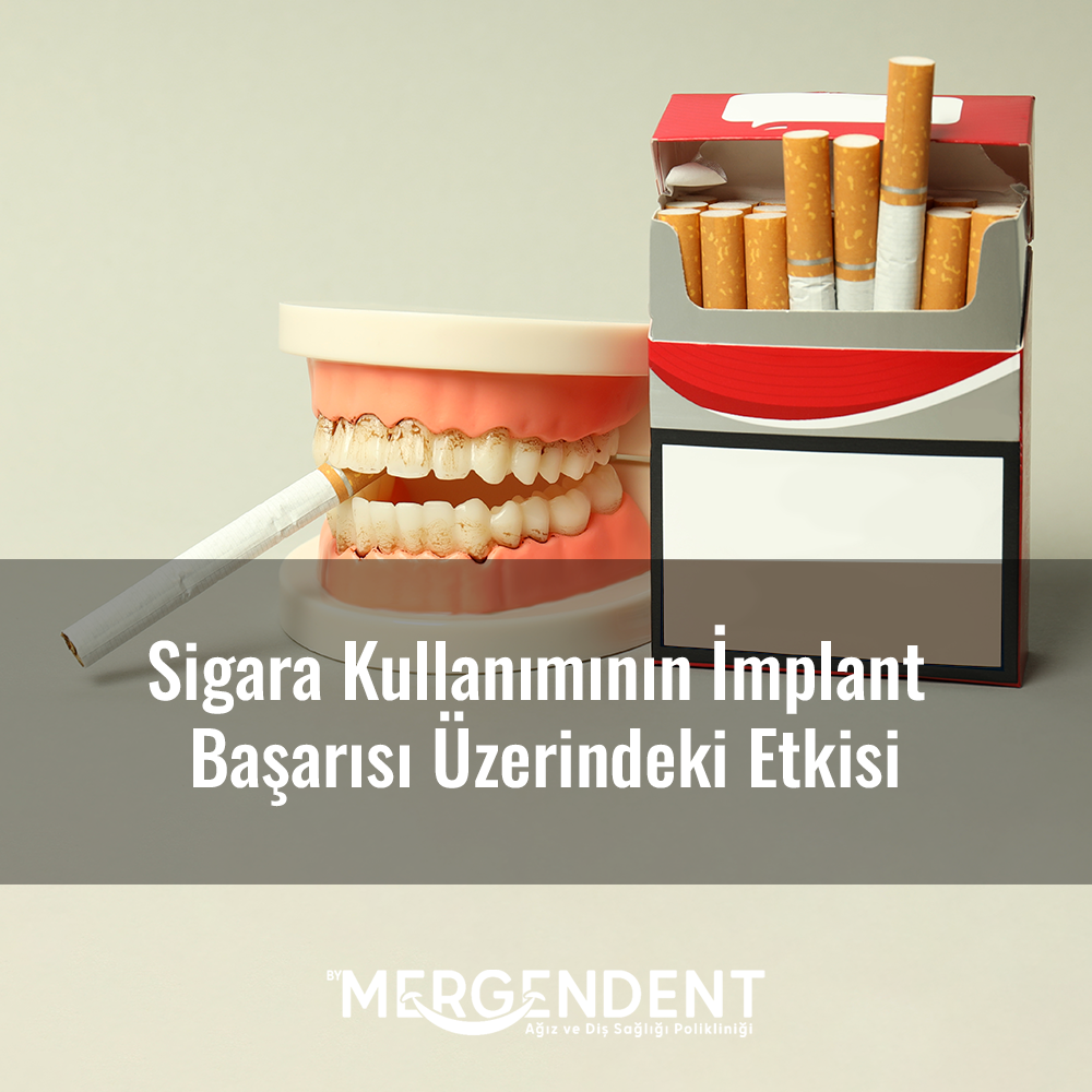 sigara kullanımının implant tedavisine etkisi, sigara ve implant tedavisi