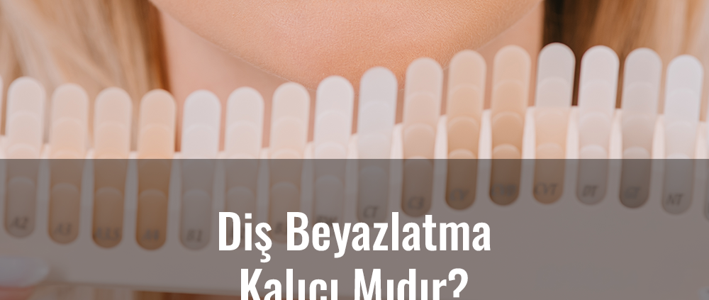 diş beyazlatma kalıcı mıdır?