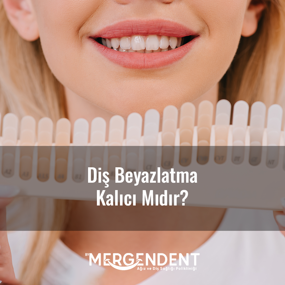 diş beyazlatma kalıcı mıdır?