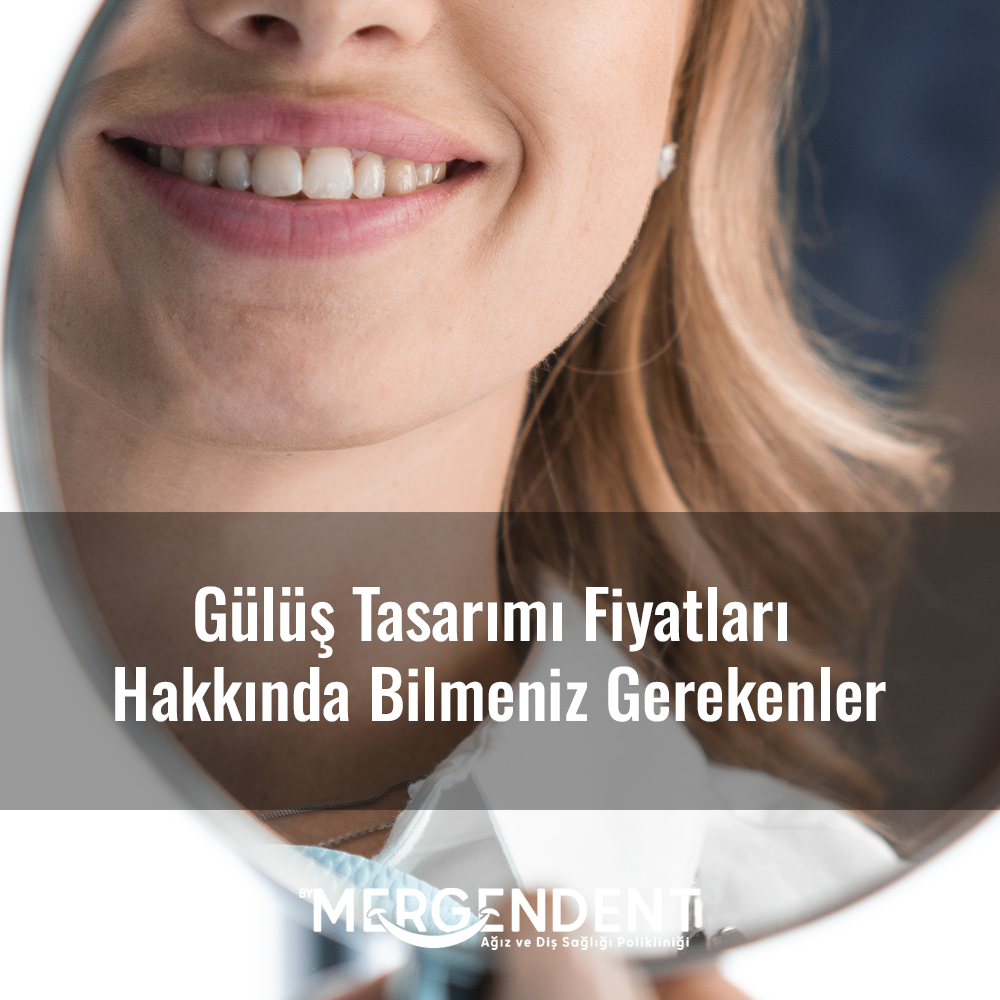 gülüş tasarımı fiyatları hakkında bilmeniz gerekenler
