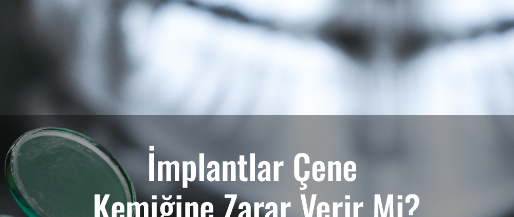 implantlar çene kemiğine zarar verir mi?