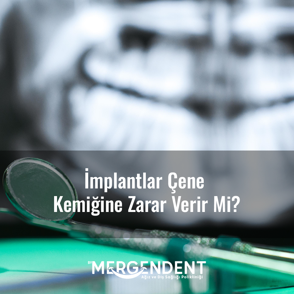 implantlar çene kemiğine zarar verir mi?